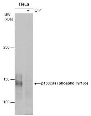 Western Blot: p130Cas/BCAR1 [p Tyr165] Antibody [NBP3-13075]